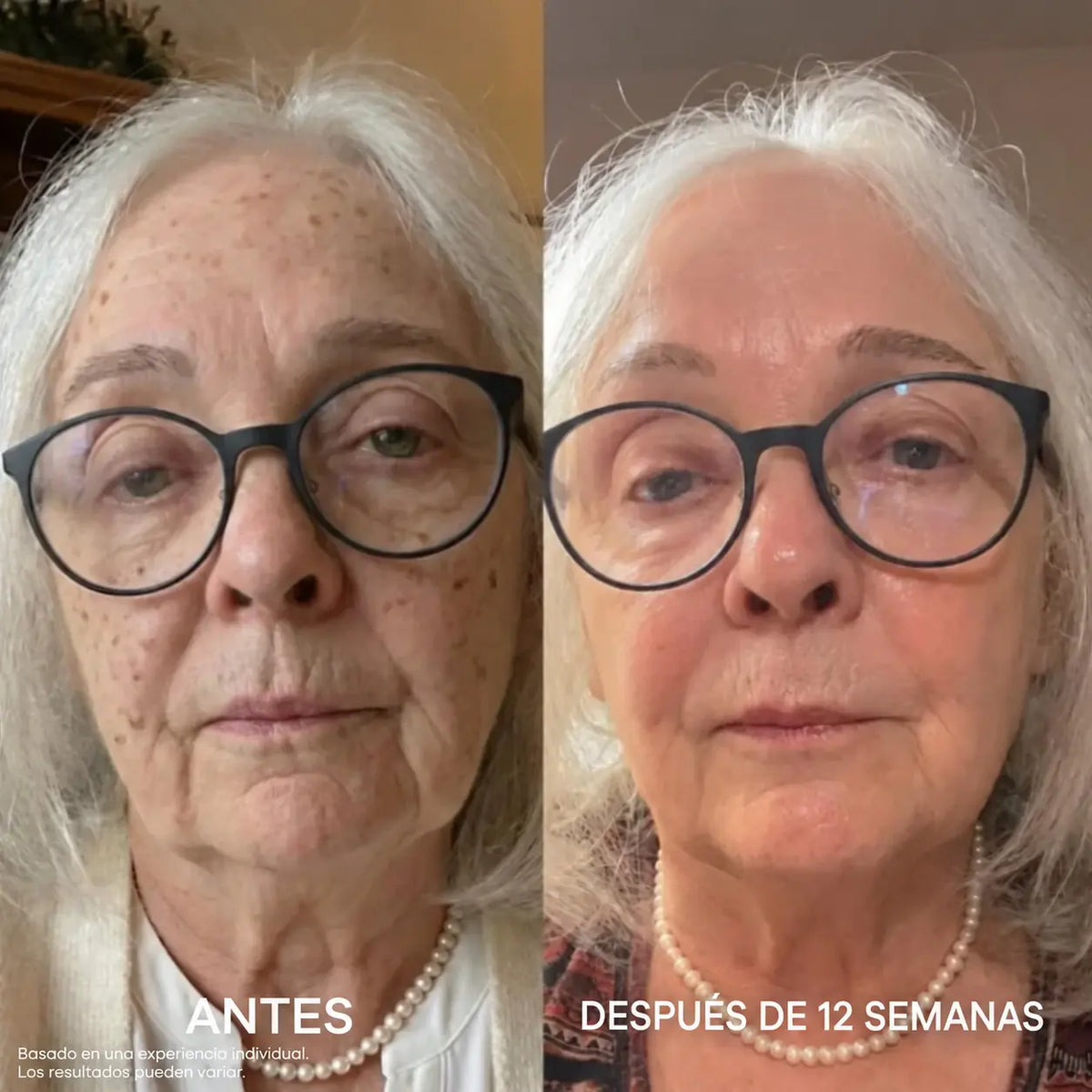 Collagen Fix™
