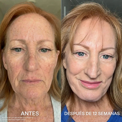 Collagen Fix™
