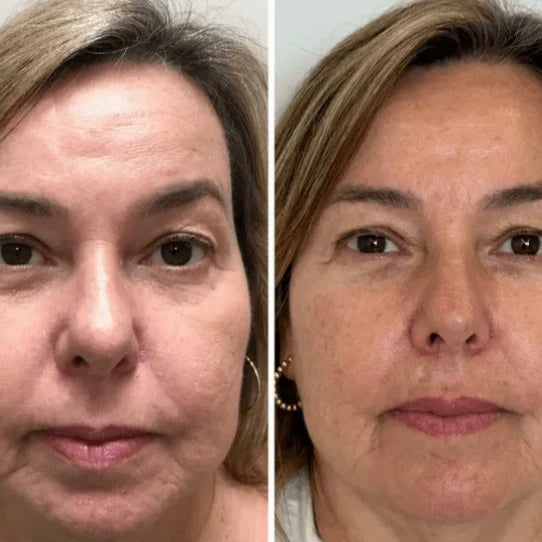 Collagen Fix™
