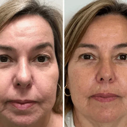 Collagen Fix™